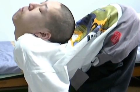 “折叠男孩”跪着上课考上大学，祝他手术顺利！